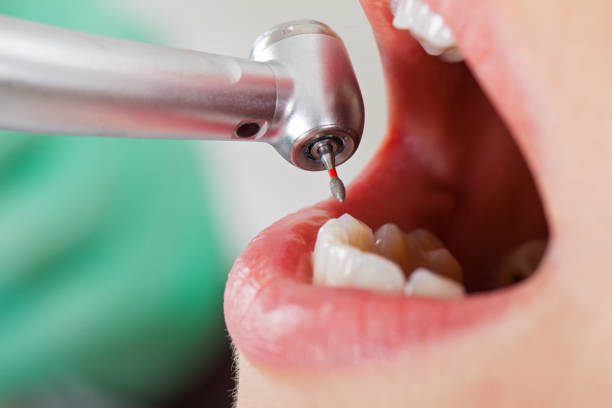 Best Walk-In Emergency Dentist in Encantada Ranchito El Calaboz, TX